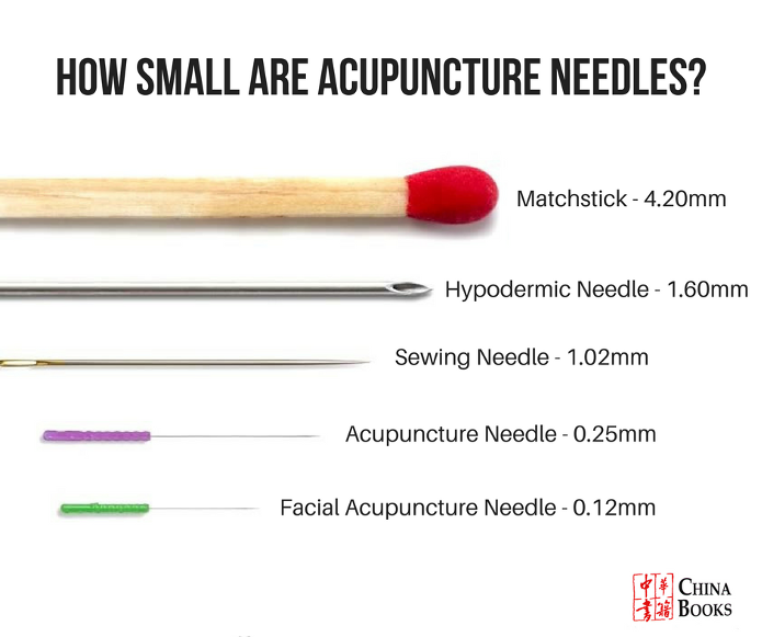 acupuncture needlee points