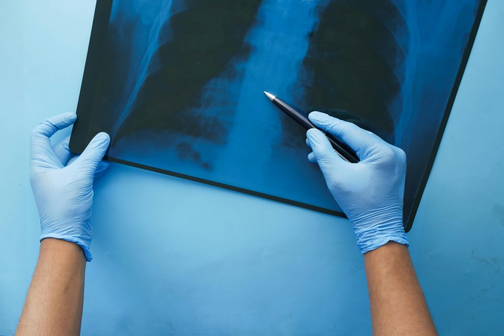 Doctor reviewing spinal X-Ray